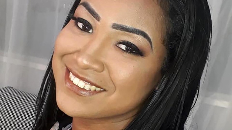 25 YAŞINDAKİ KADIN ESTETİK KURBANI OLDU